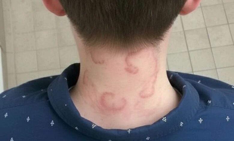 My 8 year old son been having this for 2 months straight it’s gotten worse from the first time he had this.. What is it