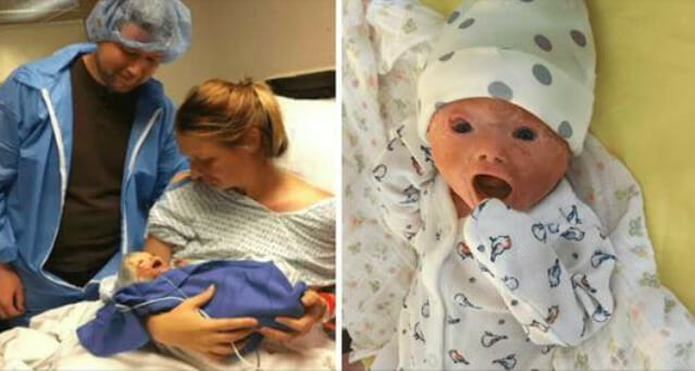 ”My baby's skin hardened & split seconds after birth – but she isn't any less beautiful”