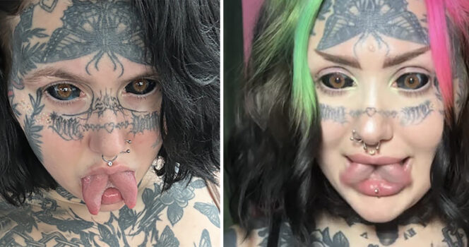 Orylan spent $70K on extreme makeover – shocks with before photos