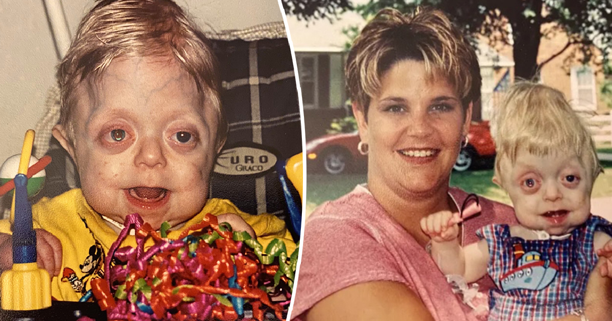 Teen who wasn't expected to live past 18 months graduates high school – well done,